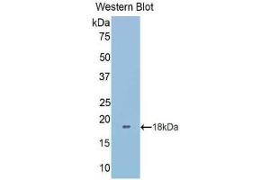 Western blot analysis of the recombinant protein. (LGALS9B 抗体  (AA 228-355))