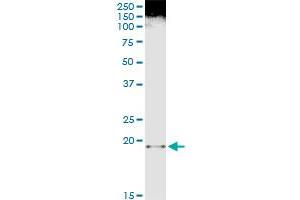 Immunoprecipitation of FTL transfected lysate using anti-FTL monoclonal antibody and Protein A Magnetic Bead , and immunoblotted with FTL purified MaxPab rabbit polyclonal antibody. (FTL 抗体  (AA 1-175))