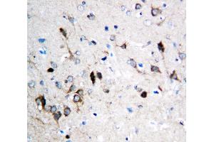 Anti-NMDAR1 antibody, IHC(P) IHC(P): Rat Brain Tissue
