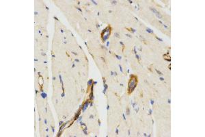 Immunohistochemistry of paraffin-embedded mouse heart using LAMP3 antibody (ABIN5971497) at dilution of 1/200 (40x lens). (LAMP3 抗体)