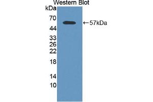 Detection of Recombinant CAPN2, Human using Polyclonal Antibody to Calpain 2 (CAPN2) (Calpain 2 抗体  (AA 45-514))