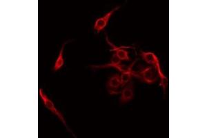 ABIN6275298 staining COLO205 by IF/ICC. (Neurexophilin 4 抗体  (Internal Region))