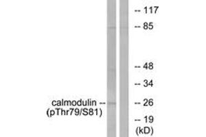 Western blot analysis of extracts from Jurkat cells treated with Insulin 0. (Calmodulin 1 抗体  (pThr79))