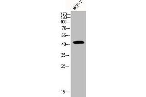 Western Blot analysis of MCF7 cells using Phospho-YAP (S127) Polyclonal Antibody (YAP1 抗体  (pSer127))