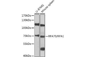 Western blot analysis of extracts of various cell lines, using RP/RP/RP antibody (ABIN3021243, ABIN3021244, ABIN3021245 and ABIN6214082) at 1:1000 dilution. (RPA1 抗体  (AA 367-616))
