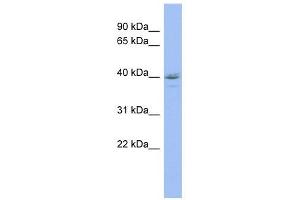 HDAC11 antibody used at 1 ug/ml to detect target protein. (HDAC11 抗体  (Middle Region))