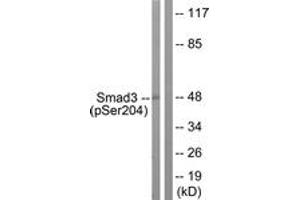 Western blot analysis of extracts from NIH-3T3 cells treated with Serum 20% 15', using Smad3 (Phospho-Ser204) Antibody.