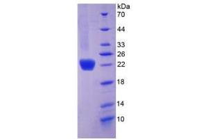 SDS-PAGE analysis of Mouse COL6a1 Protein. (COL6A1 蛋白)