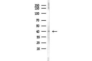 Western blot analysis of lysates from HepG2 cells(starvation,24h treatment), using Phospho-MKK3/MKK6 (Ser189/Ser207) Antibody at 1/1000 dilution.