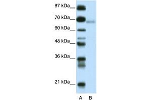 WB Suggested Anti-ZBTB22 Antibody Titration:  0. (ZBTB22 抗体  (C-Term))