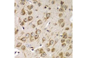 Immunohistochemistry of paraffin-embedded mouse brain using TMED10 Antibody (ABIN5974099) at dilution of 1/100 (40x lens). (TMED10 抗体)