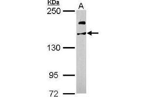 WB Image Sample (50 ug of whole cell lysate) A: Mouse brain 5% SDS PAGE antibody diluted at 1:1000 (USP47 抗体)