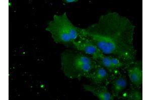 Anti-POR mouse monoclonal antibody (ABIN2453490) immunofluorescent staining of COS7 cells transiently transfected by pCMV6-ENTRY POR (RC202172). (POR 抗体)