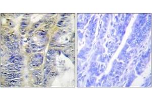 Immunohistochemistry (IHC) image for anti-Collagen, Type IV, alpha 5 (COL4A5) (AA 21-70) antibody (ABIN1534341)
