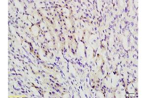 Immunohistochemistry (Paraffin-embedded Sections) (IHC (p)) image for anti-Transducin (Beta)-Like 1, Y-Linked (TBL1Y) (AA 501-577) antibody (ABIN705416)