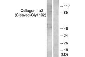 Western blot analysis of extracts from Jurkat cells, treated with etoposide 25uM 24h, using Collagen I alpha2 (Cleaved-Gly1102) Antibody. (COL1A2 抗体  (Cleaved-Gly1102))