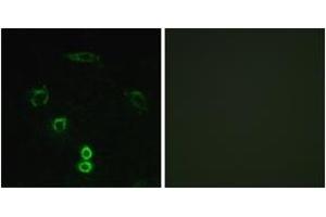Immunofluorescence analysis of A549 cells, using GLCTK Antibody. (GLYCTK 抗体  (AA 101-150))