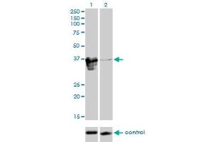 Western blot analysis of ZFP36L1 over-expressed 293 cell line, cotransfected with ZFP36L1 Validated Chimera RNAi (Lane 2) or non-transfected control (Lane 1). (ZFP36L1 抗体  (AA 1-108))