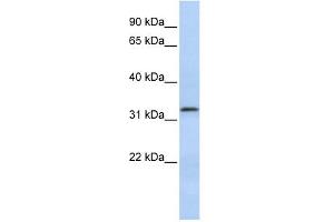 Beta Lactamase 2 antibody used at 1 ug/ml to detect target protein. (LACTB2 抗体  (Middle Region))