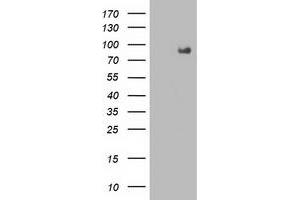 Western Blotting (WB) image for anti-Fibroblast Growth Factor Receptor 2 (FGFR2) antibody (ABIN1498249) (FGFR2 抗体)