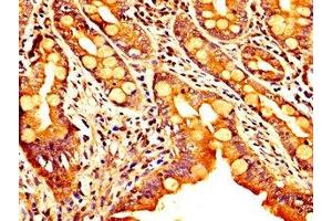Immunohistochemistry (IHC) image for anti-Sema Domain, Immunoglobulin Domain (Ig), Transmembrane Domain (TM) and Short Cytoplasmic Domain, (Semaphorin) 4B (SEMA4B) (AA 163-253) antibody (ABIN7168797)