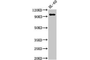 Western Blot Positive WB detected in: HL60 whole cell lysate All lanes: KMT5B antibody at 3 μg/mL Secondary Goat polyclonal to rabbit IgG at 1/50000 dilution Predicted band size: 100, 45, 32 kDa Observed band size: 100 kDa (SUV420H1 抗体  (AA 100-150))