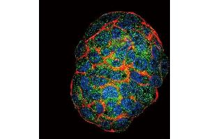 Confocal immunofluorescent analysis of GBE1 Antibody (Center) (ABIN653459 and ABIN2842890) with HepG2 cell followed by Alexa Fluor? (GBE1 抗体  (AA 527-556))