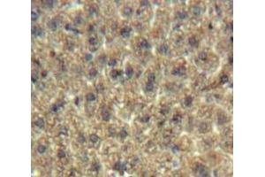 #VALUE! (C19ORF80 抗体  (AA 16-198))