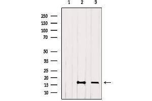 Western Blotting (WB) image for anti-Histone H4 (acLys12) antibody (ABIN6254899)