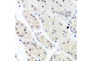 Immunohistochemistry of paraffin-embedded human stomach using HNRNPCL1 antibody (ABIN5995850) at dilution of 1/100 (40x lens). (HNRNPCL1 抗体)