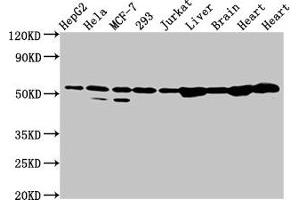 Western Blot Positive WB detected in: HepG2 whole cell lysate, Hela whole cell lysate, MCF-7 whole cell lysate, 293 whole cell lysate, Jurkat whole cell lysate, Rat liver tissue, Rat brain tissue, Rat heart tissue, Mouse heart tissue All lanes: DLD antibody at 2 μg/mL Secondary Goat polyclonal to rabbit IgG at 1/50000 dilution Predicted band size: 55, 44, 50 kDa Observed band size: 55 kDa (DLD 抗体  (AA 398-495))