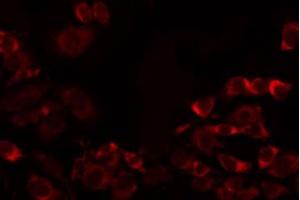ABIN6274738 staining MCF7 by IF/ICC. (MRPL32 抗体  (Internal Region))