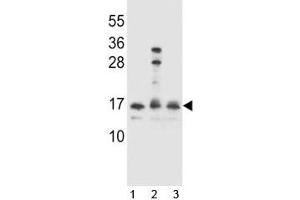 HOPX antibody western blot analysis in 1) Ramos, 2) A2058 and 3) 293 lysate. (HOPX 抗体  (AA 39-67))