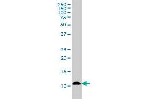 S100A7 monoclonal antibody (M02), clone 1A4 Western Blot analysis of S100A7 expression in A-431 .