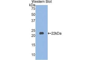 Detection of Recombinant MYL3, Human using Polyclonal Antibody to Myosin Light Chain 3, Alkali, Ventricular, Slow Skeletal (MYL3) (MYL3/CMLC1 抗体  (AA 5-181))