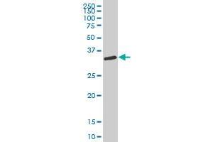 CAPZA1 polyclonal antibody (A01), Lot # 051129JC01 Western Blot analysis of CAPZA1 expression in HL-60 . (CAPZA1 抗体  (AA 1-286))