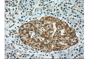 Immunohistochemical staining of paraffin-embedded Kidney tissue using anti-TYRO3mouse monoclonal antibody. (TYRO3 抗体)