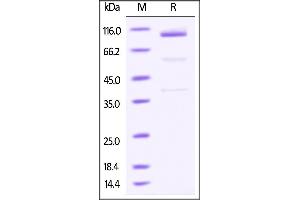 SDS-PAGE (SDS) image for Glypican 3 (GPC3) (AA 25-557) (Active) protein (Fc Tag) (ABIN4949172)