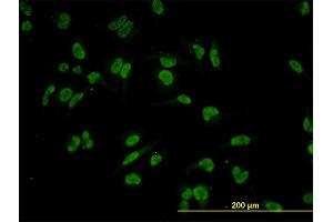 Immunofluorescence of monoclonal antibody to TRIM24 on HeLa cell. (TRIM24 抗体  (AA 432-569))