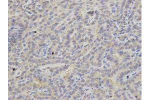 Immunohistochemistry (IHC) image for anti-Adenine Phosphoribosyltransferase (APRT) antibody (ABIN1876644) (APRT 抗体)