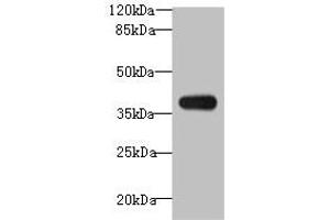 Western blot All lanes: ASB7 antibody at 8 μg/mL + A431 whole cell lysate Secondary Goat polyclonal to rabbit IgG at 1/10000 dilution Predicted band size: 37, 31 kDa Observed band size: 37 kDa (ASB7 抗体  (AA 1-274))