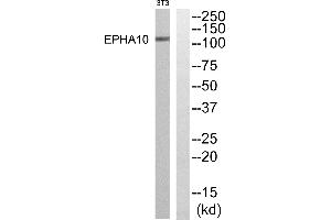 Western blot analysis of extracts from NIH-3T3 cells, using EPHA10 antibody.