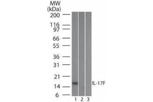 Western Blot of Mouse Anti-IL-17F antibody Lane 1: human full length recombinant IL-17F protein Lane 2: mouse full length recombinant IL-17F protein Lane 3: rat full length recombinant IL-17F protein Load: 20 ng/lane Primary antibody: Anti-IL-17F antibody at 0. (IL17F 抗体  (Biotin))