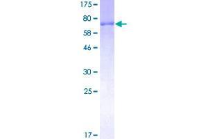 TRIP6 Protein (AA 1-476) (GST tag)