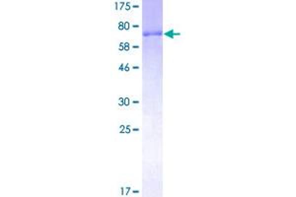 TRIP6 Protein (AA 1-476) (GST tag)