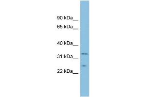 WB Suggested Anti-MSRA Antibody Titration: 0. (MSRA 抗体  (Middle Region))
