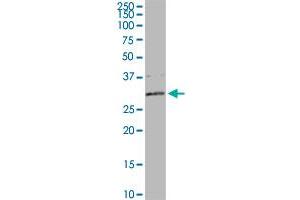 DCI MaxPab rabbit polyclonal antibody.