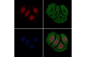 ABIN6262334 and ABIN6279483 staining Hela cells by IF/ICC. (HNRPDL 抗体  (C-Term))