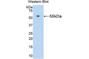 Western Blotting (WB) image for anti-Angiotensinogen (serpin Peptidase Inhibitor, Clade A, Member 8) (AGT) (AA 25-477) antibody (ABIN3207838) (AGT 抗体  (AA 25-477))