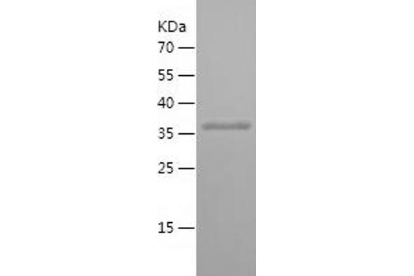 RABEPK Protein (AA 120-367) (His tag)